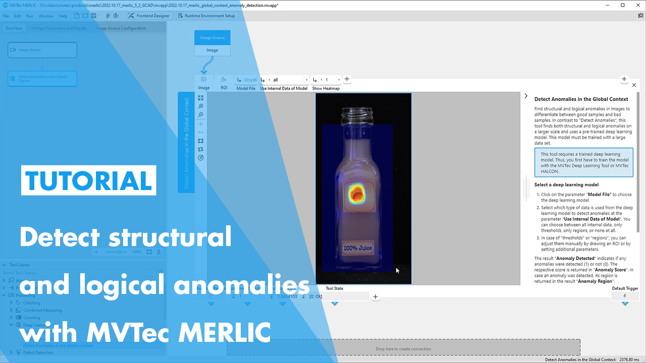 video thumbnail: Detect structural and logical anomalies with MVTec MERLIC