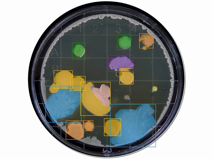 Highly accurate identification and measurement of bacteria in petri dish with MVTec software.