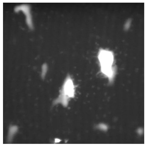 Tissue particles in dark liquid before blob analysis with MVTec software.