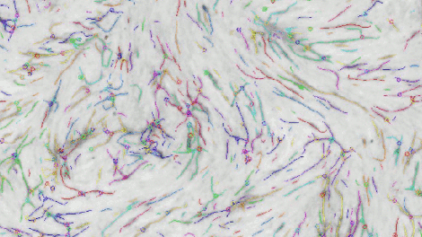 Angiogenesis: Testing the growth of new blood vessels.