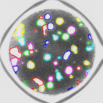 automatically distinguish and count bacteria cultures.