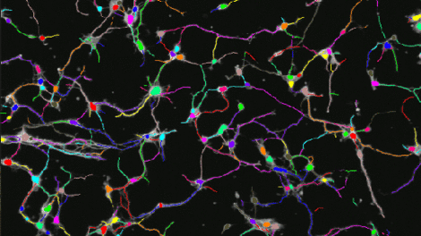Axons: Finding cell nuclei with our software