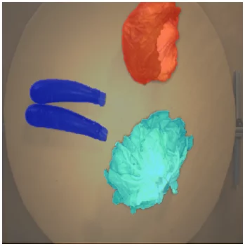 Result of semantic segmentation with MVTec software.