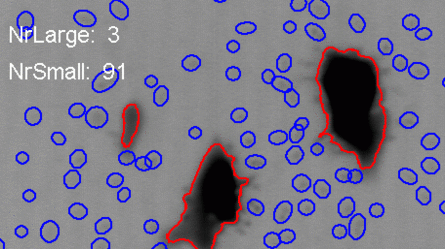 automatically count cell nuclei in cytoplasm in images with a low signal-to-noise ratio.